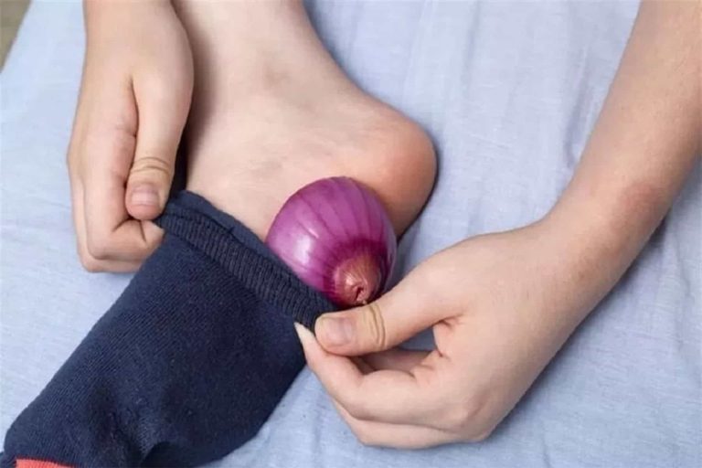 بصلة على باطن القدم watanserb.com