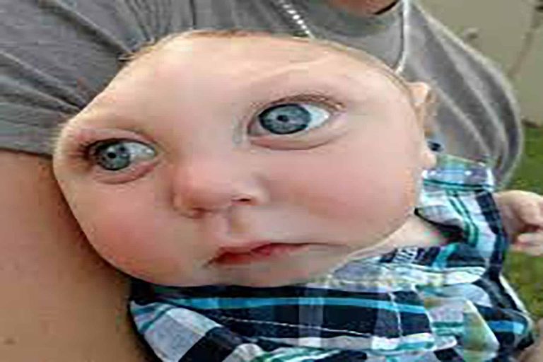 طفل بلا جمجمة watanserb.com