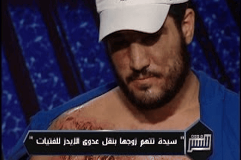 امرأة تحرق زوجها بالأسيد watanserb.com