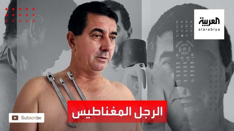 الرجل المغناطيسي .. جسده قادر على جذب أكثر من 10 كيلو غرامات! الرجل المغناطيسي