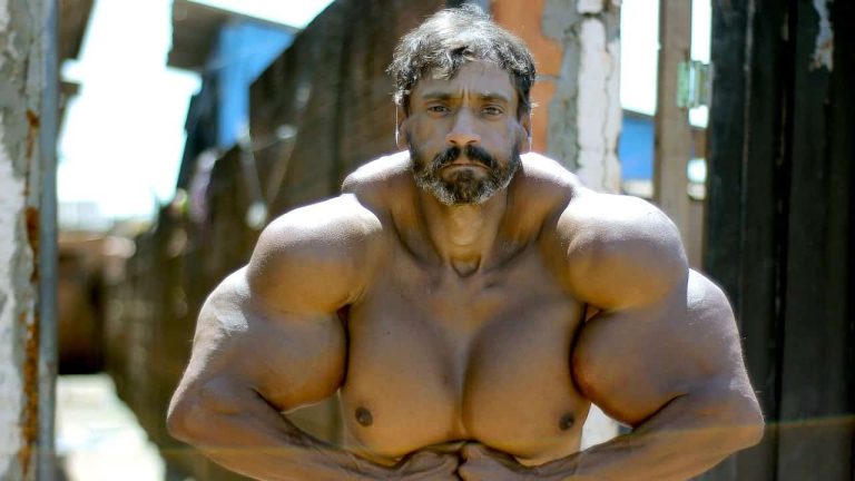 هذا الرجل بنى عضلاته بحقنها بعقار للحيوانات