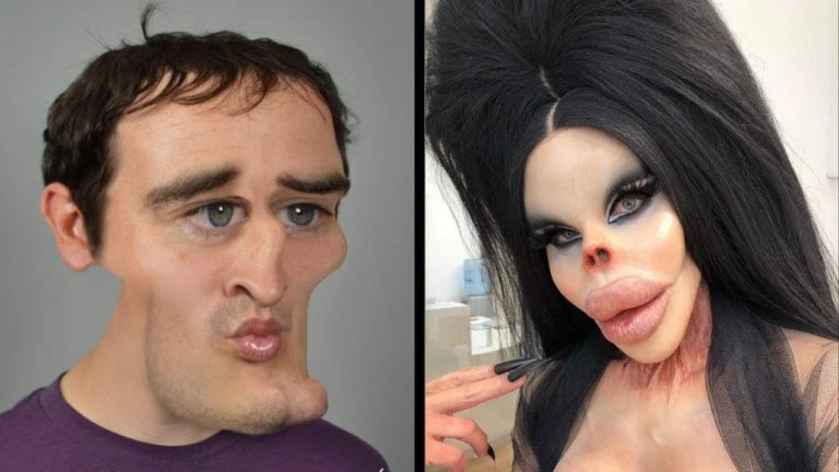 أبشع 10 عمليات تجميل انتهت بنتائج كارثية
