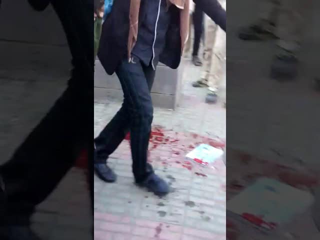 لحظة انفجار قنبلة أحضرها طالب ليلهو بها داخل مدرسة بصنعاء “فيديو” لحظة انفجار قنبلة أحضرها طالب