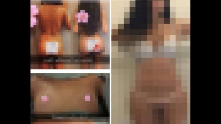 جراح تجميل مغربي شهير ينشر صور مريضاته عاريات watanserb.com