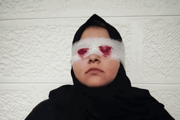 اقتلع عيني زوجته بالأردن watanserb.com