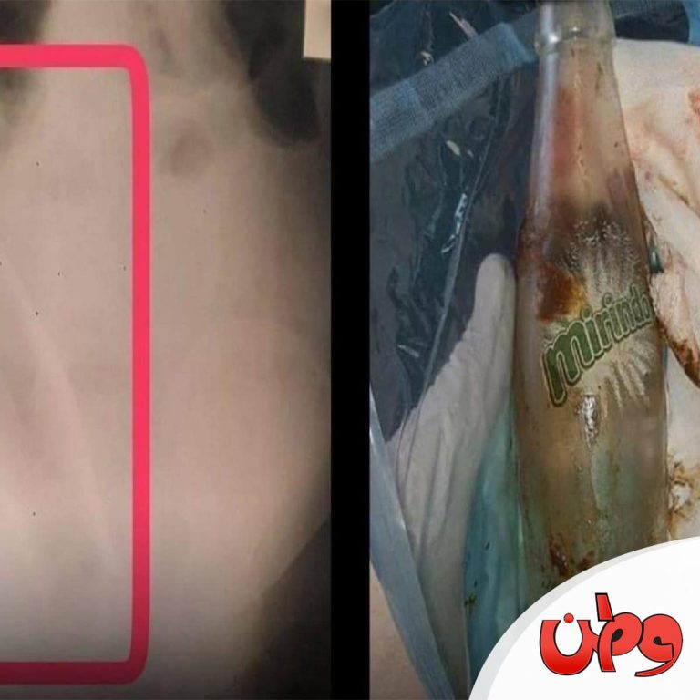 عملية جراحية غريبة watanserb.com