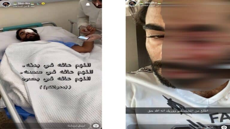 عبودكا يروي تفاصيل الاعتداء عليه watanserb.com