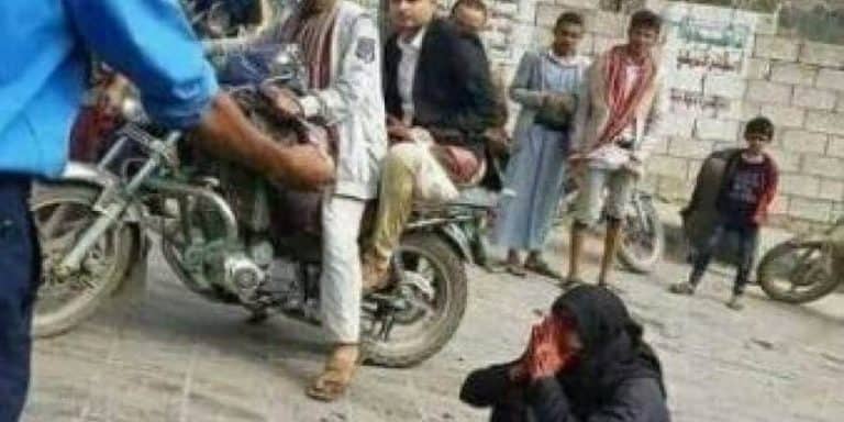 ليست لقطة من فيلم رعب.. “شاهد” ما فعلته زوجة مواطن يمني مغدور قتله مرافق لمدير أمن “حجة” على الملأ زوجة الشيخ حميد طفيان watanserb.com