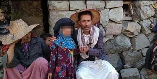 “شاهد” يمني “خسيس” يبيع ابنته بعقد موثق ووسم “ساعدوا ليمون” يغزو مواقع التواصل! الطفلة اليمنية ليمون ساعدوا ليمون watanserb.com