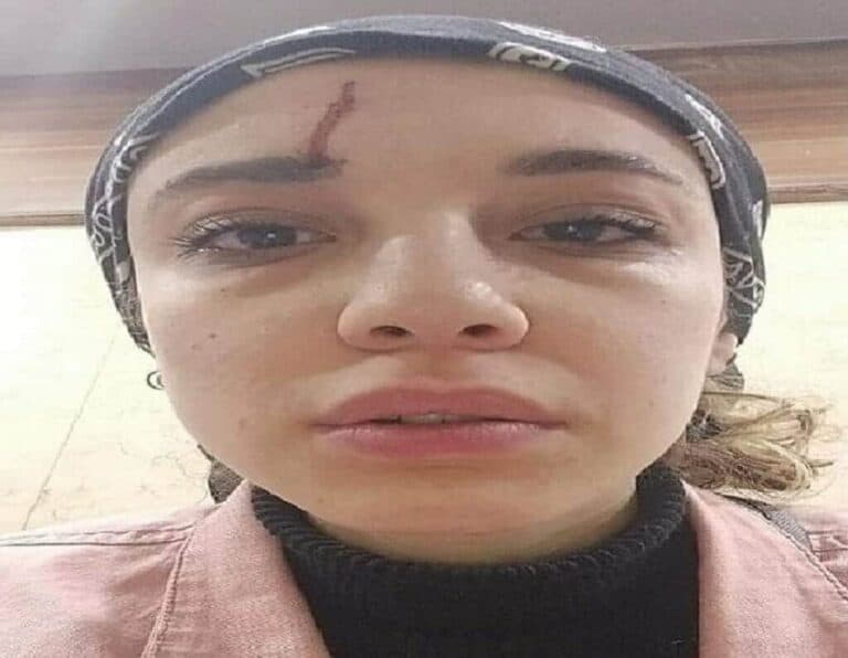 فتاة مصرية تتعرض للتحرش وتثير ضجة واسعة watanserb.com