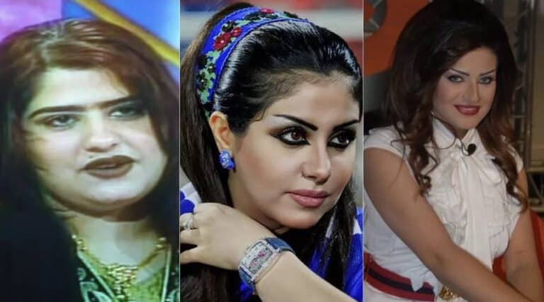 صور صادمة لـِ3 نجمات كويتيات قبل وبعد عمليات التجميل! (شاهد) أمل العوضي - حليمة بولند - شمس الكويتية / صور قبل وبعد عمليات التجميل watanserb.com
