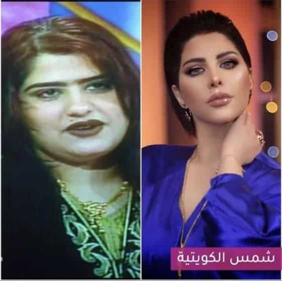 شمس الكويتية قبل وبعد