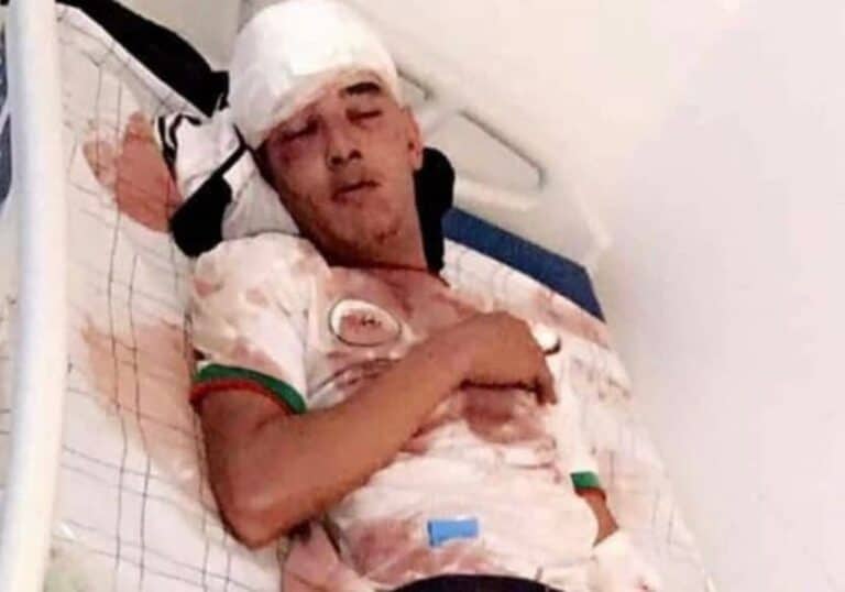 مغاربة يعتدون على فتى صحراوي لارتدائه قميص المنتخب الجزائري watanserb.com