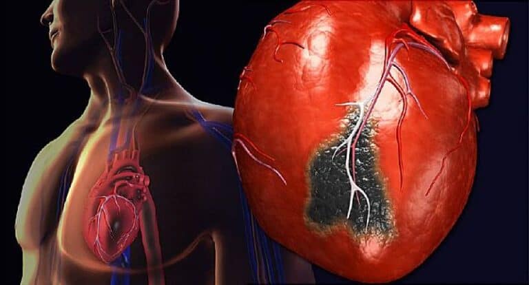 7 علامات خفية تدل على مشاكل في القلب مشاكل في القلب watanserb.com
