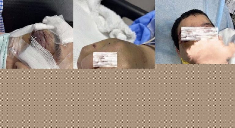 صور تعذيب منى الشريف تهز السعودية والنائب العام يصدر أوامر صارمة! watanserb.com
