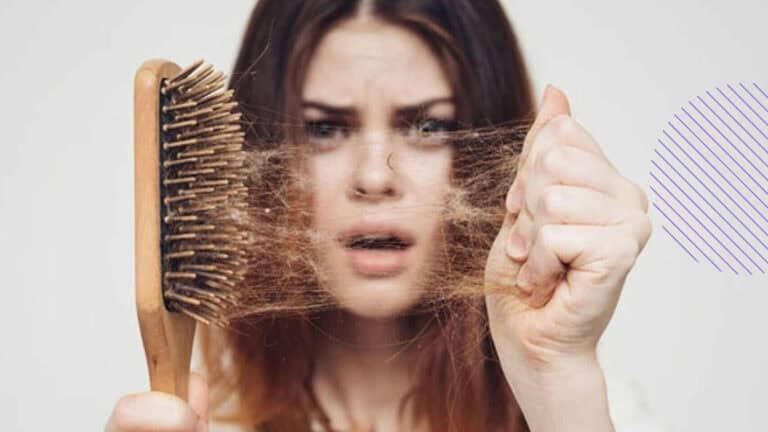 تساقط الشعر بسبب الإجهاد.. 5 طرق فعالة لمحاربة الأمر تساقط الشعر بسبب الإجهاد.. 5 طرق فعالة لمحاربة الأمر watanserb.com