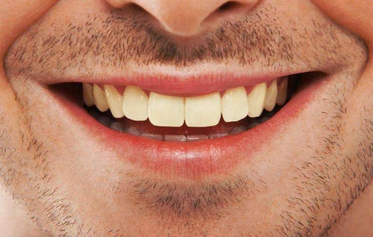 الشفاه كما في باطن القدمين وراحة اليد، ليس بها بصيلات شعر