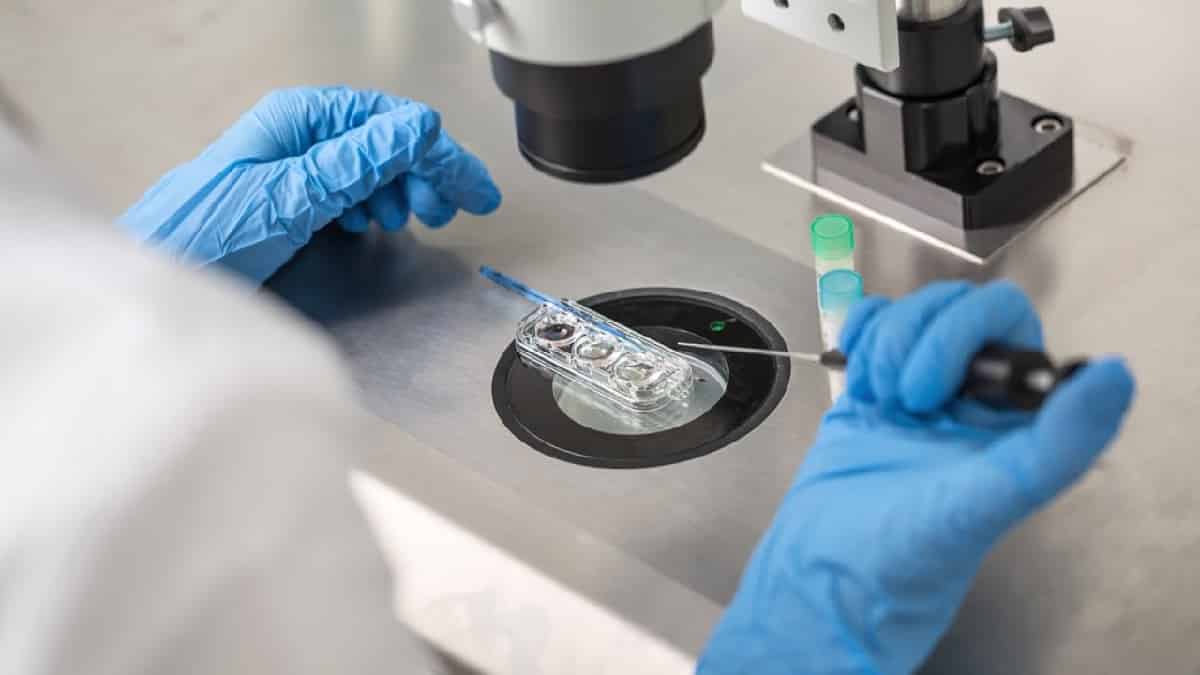 الإخصاب في المختبر (IVF)