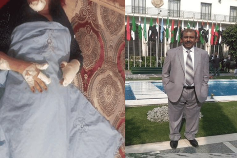 يمني يعتدي على زوجته بالساطور بسبب “خروف”.. تفاصيل قاسية (فيديو) يمني يعتدي على زوجته بالساطور watanserb.com