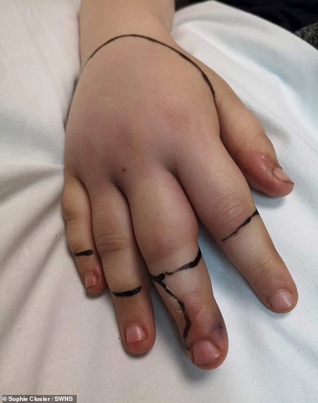 طفلة تعض أفعى