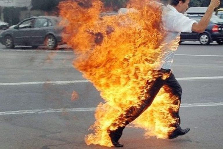تونسي يضرم النار في جسده.. السبب مجهول وحالته خطيرة تونسي يضرم النار في جسده watanserb.com