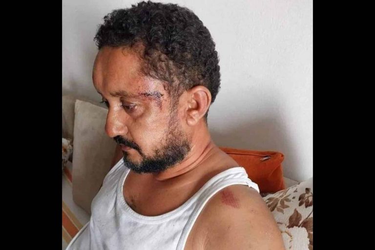 سفيان بن نجيمة.. سحل صحفي تونسي على يد الأمن يفجر موجة غضب سفيان بن نجيمة watanserb.com