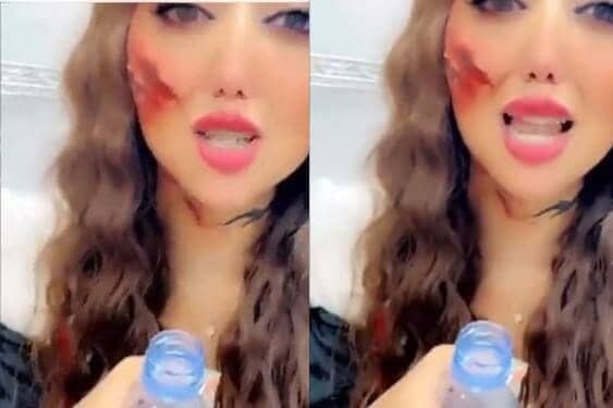 ليان عبدالله في حالة انهيار.. فيديو صادم يوثق لحظة التحرش الجماعي بها في بوليفارد الرياض! (شاهد) ليان عبدالله في حالة انهيار.. فيديو صادم يوثق لحظة التحرش الجماعي بها في بوليفارد الرياض! (شاهد) watanserb.com