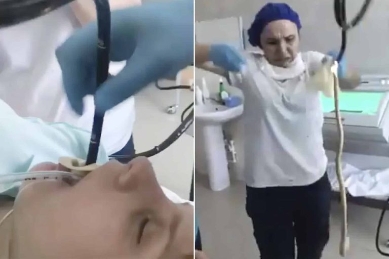 ثعبان يتسلل داخل جسد سيدة بطريقة لا تُصدق.. والأطباء يقفزون خوفاً! (شاهد) watanserb.com