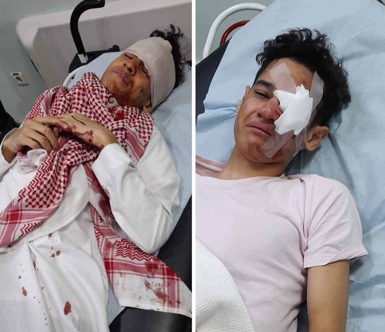 طالب سعودي سحل زميله المصري وفقأ عينه.. ومطالبات “بحق زياد” الاعتداء على طالب مصري في السعودية watanserb.com