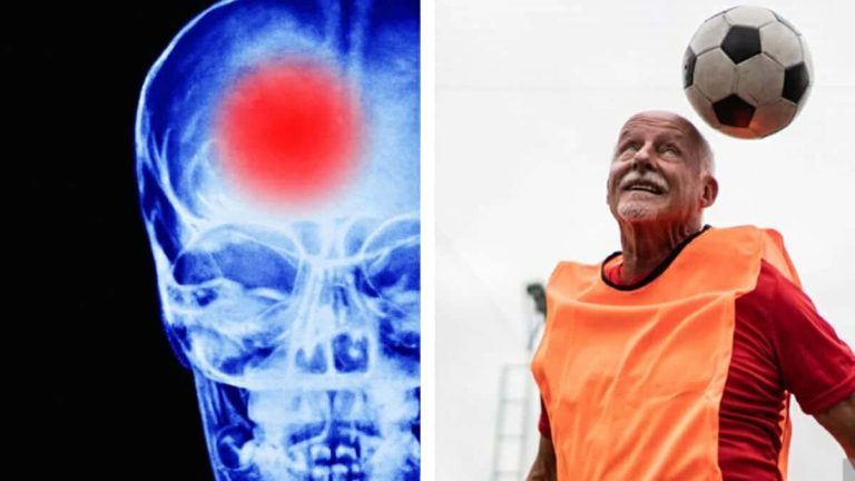 لاعبي كرة القدم أكثر عرضة لمشاكل الدماغ watanserb.com