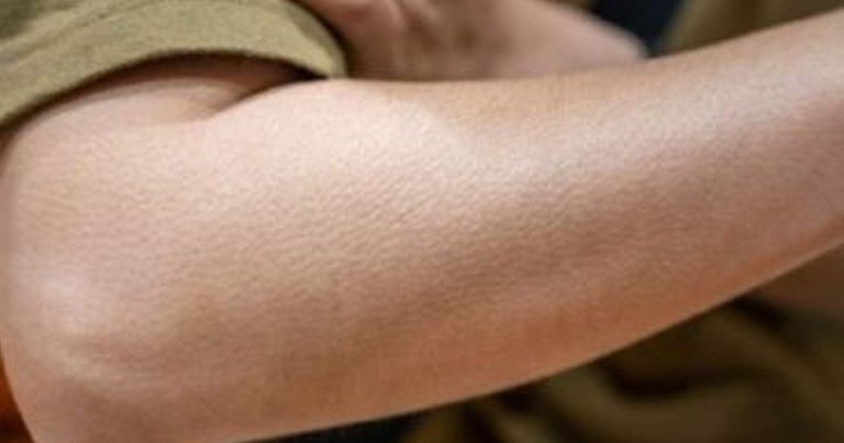 حرق السعرات الحرارية في الشتاء watanserb.com
