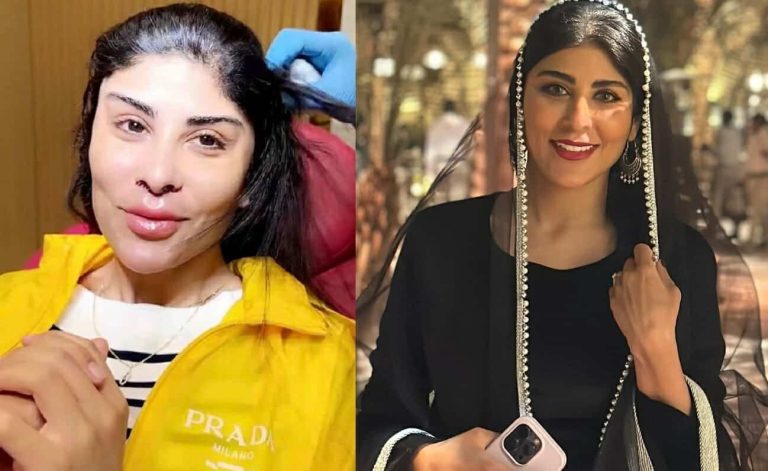 زارا البلوشي بعد عملية التجميل watanserb.com
