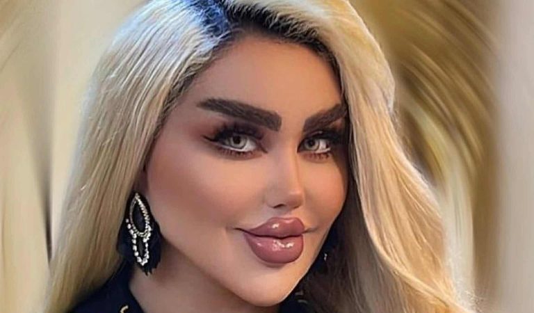 داليا نعيم.. صُحف عالمية تكشف صورتها الحقيقية قبل تكبير الثدي والشفاه! watanserb.com