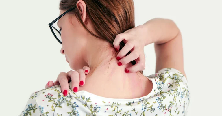 أطباء يعثرون على ديدان تزحف تحت جلد امرأة بعدما تناولت هذه الوجبة watanserb.com