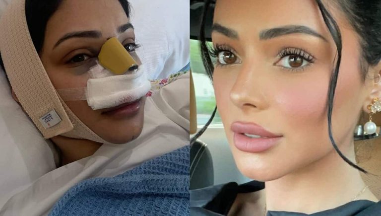 شوق الهادي تنشر صوراً “صادمة” لعملية تجميل جعلتها تعيش أسوأ شهرين في حياتها! (شاهد) شوق الهادي بعد عملية تجميل watanserb.com