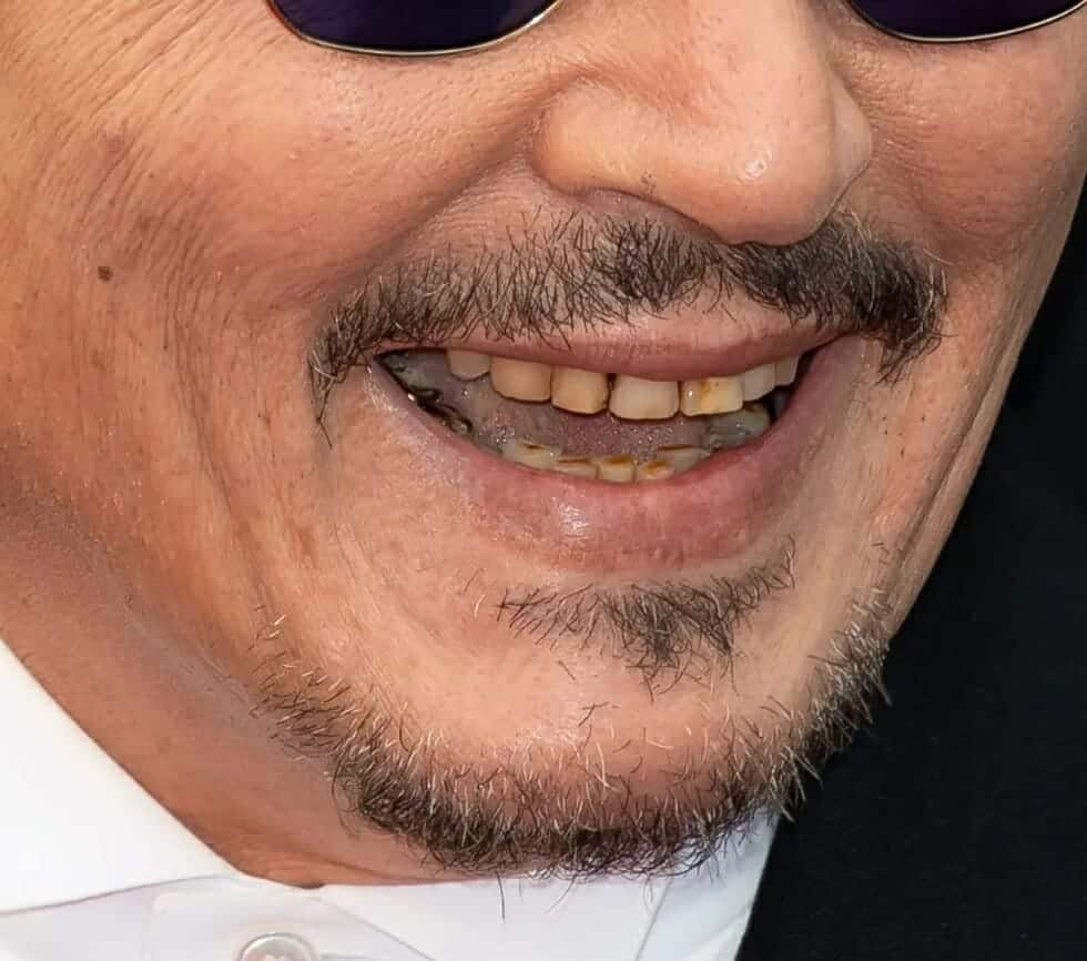 أسنان جوني ديب 