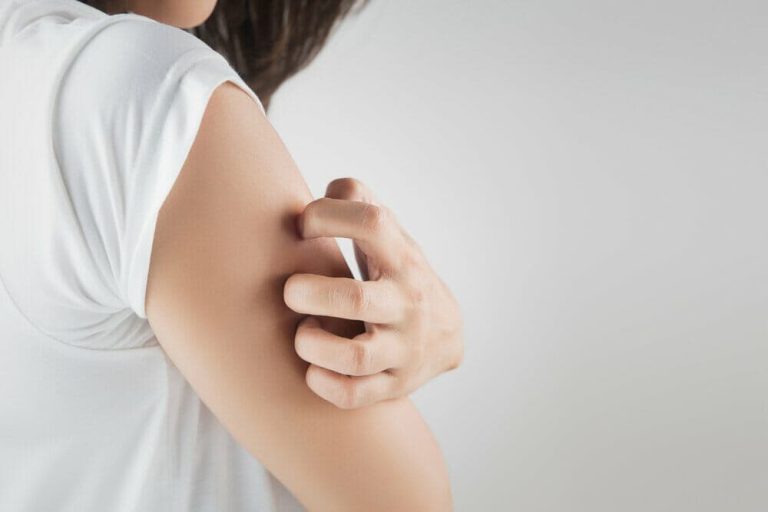 بهذه العلاجات المنزلية يمكنك التخلص من لدغات البعوض بشكل نهائي! watanserb.com