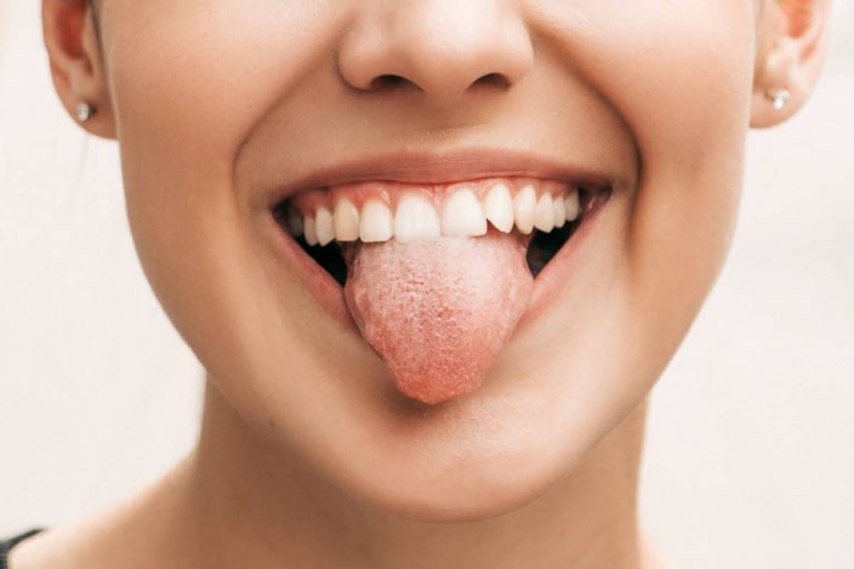 لماذا تشعر بحكة في لسانك عند تناول هذه الفاكهة؟ الأناناس watanserb.com