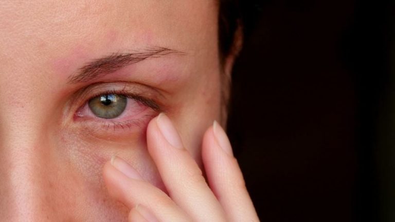 لا تتجاهلهما..علامتان في العين تخبرك أن وضعك الصحي سيئ watanserb.com