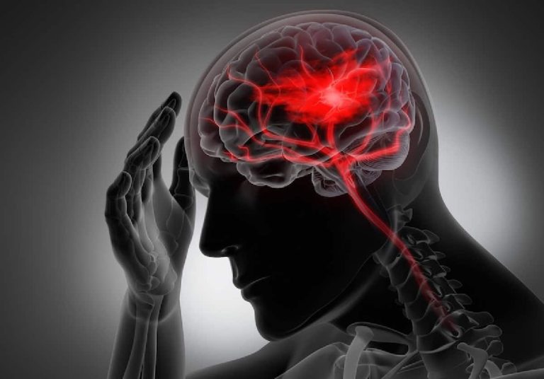 السكتة الدماغية: أعراضها وأسبابها والوقاية منها يعتمد علاج السكتة الدماغية على نوعه وشدته