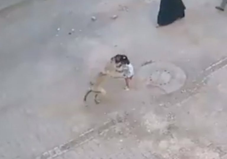 قضم وجهها.. فيديو مرعب لهجوم كلب ضال على طفلة