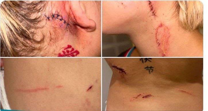 مراهقون جزائريون يشوهون شابة