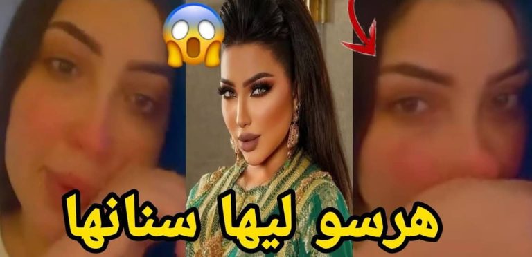 دنيا بطمة تفقد أسنانها بعد تعرضها لضرب مُبرح.. والحرب تشتعل! دنيا بطمة تفقد أسنانها بعد تعرضها لضرب مُبرح.. والحرب تشتعل!