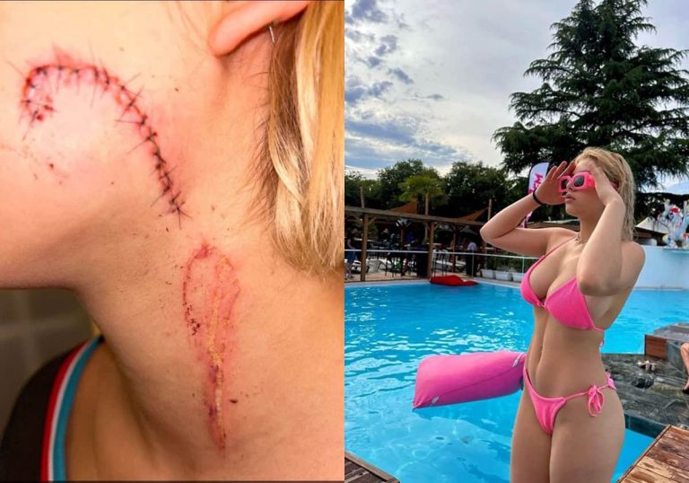 طعنات قاتلة.. مراهقون جزائريون يشوهون شابة بسبب ملابسها المثيرة طعنات قاتلة.. مراهقون جزائريون يشوهون شابة بسبب ملابسها المثيرة