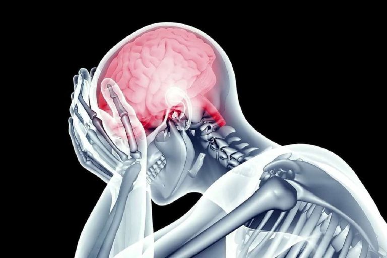 الإشارات المبكرة للسكتة الدماغية
