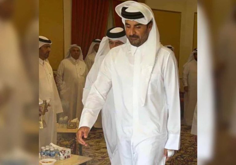 ظهر بوجه شاحب.. جرح في يد أمير قطر يلفت الأنظار ويُقلق القطريين ظهر بوجه شاحب.. جرح في يد أمير قطر يلفت الأنظار ويُقلق القطريين
