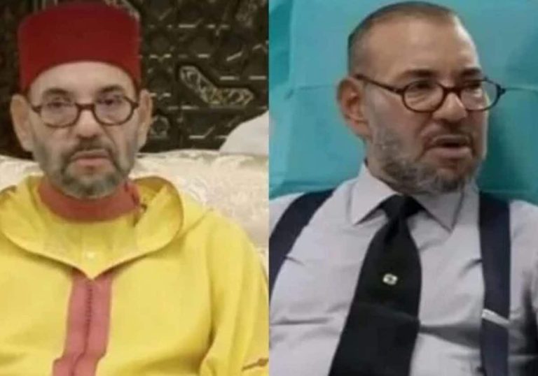 محمد السادس وشبيهه.. موقع يثير التساؤلات حول ظهوره الأخير وسر التبرع بالدم رغم الساركويد! محمد السادس وشبيهه.. موقع يثير التساؤلات حول ظهوره الأخير وسر التبرع بالدم رغم الساركويد!
