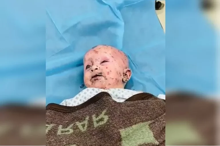 بسلاح الفسفور الأبيض المحرم دوليا.. هذا ما تفعله إسرائيل بأطفال فلسطين استخدام الفسفور الأبيض