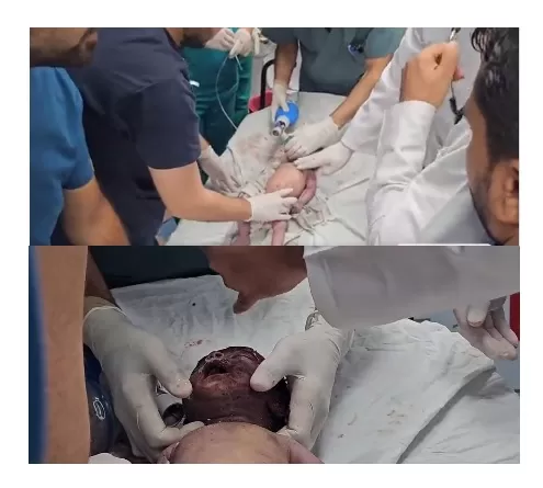 فيديو لا يتحمله بشر يوثق لحظة استشهاد رضيع فلسطيني جراء قصف إسرائيلي الأطباء يحاولون إنعاش الرضيع
