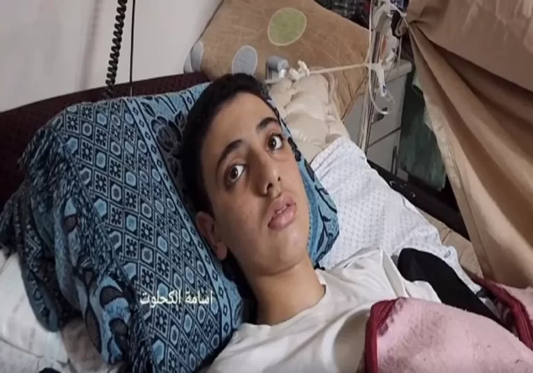 ” كان نفسي أطلع لاعب كرة قدم”.. فيديو مؤثر لفتى فلسطيني من غزة دمر الاحتلال طموحه بعد إصابته بالشلل الفتى الفلسطيني أبو الروس